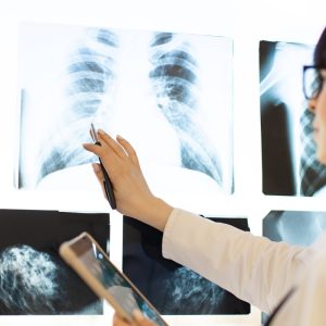 Pneumologia